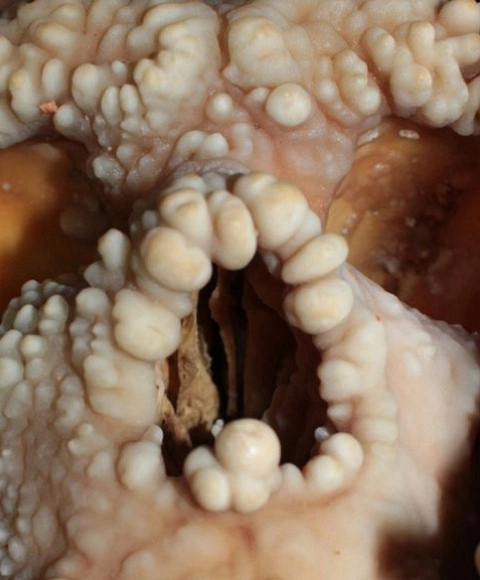 Morfología facial de un neandertal